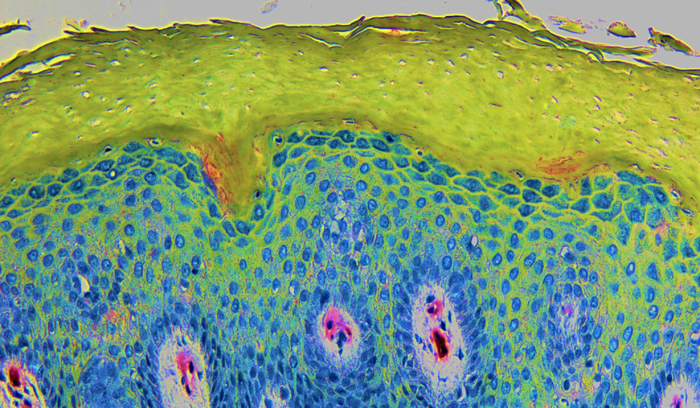 化妆品,功效评价,双光子显微技术,技术实践