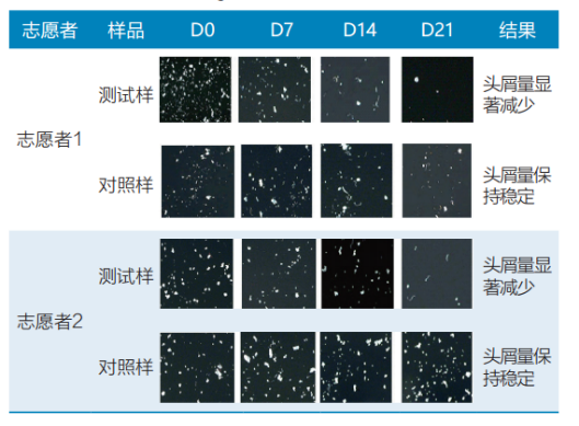 头皮,健康,头皮脱屑,头皮皮脂,CIRS,功效评价,技术实践