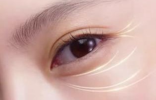 Eifficacy Evaluation and Practical Cases - Tear Troughs and Lacrimal Grooves Evaluation 